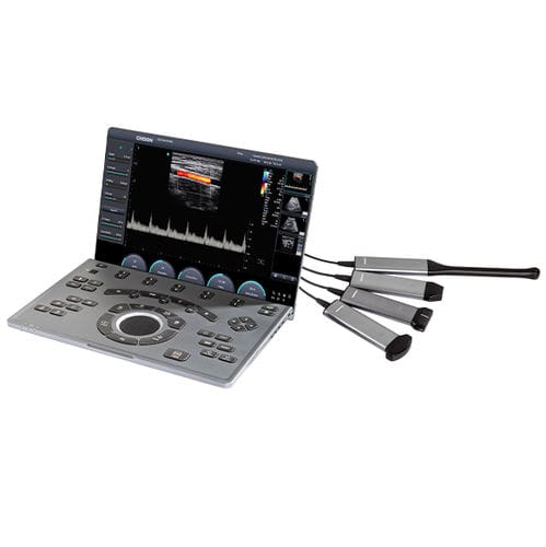 便携式B超机 - SonoAir 30 - CHISON Medical Technologies/祥生 - 用于多功能超声检查 / 妇产科用超声成像 / 用于心血管超声检查