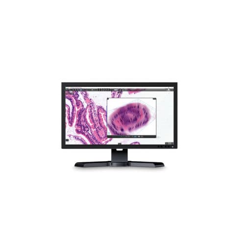 分析软件 - CaseViewer - Sysmex Europe/希森美康 - 查看 / 医用 / 平板电脑