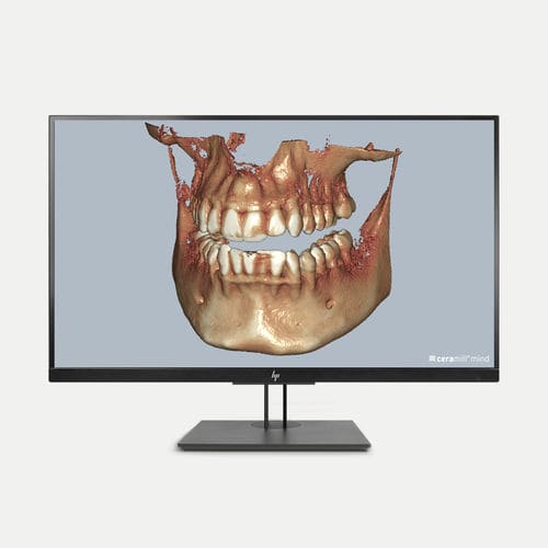DICOM可视化软件模块 - Ceramill Dicom-Viewer - Amann Girrbach - 诊断 / 控制 / CAD