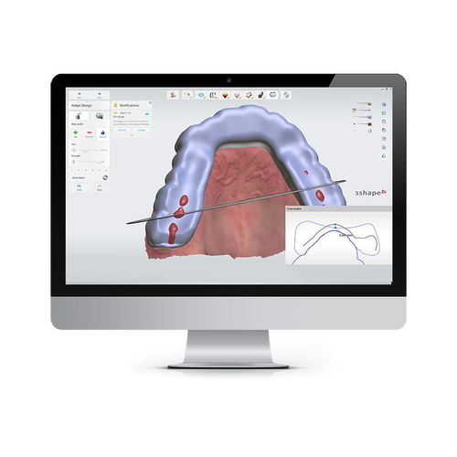 医疗控制软件 - SPLINT STUDIO - 3shape - 牙科 / 正畸 / 加工