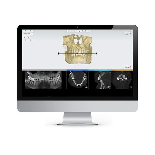 治疗计划制定软件 - Ortho Planner - 3shape - 临床 / 正畸 / 分析