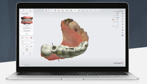 临床软件 - Implant Studio™ - 3shape - 口腔移植手术 / 用于牙科诊所 / 手术