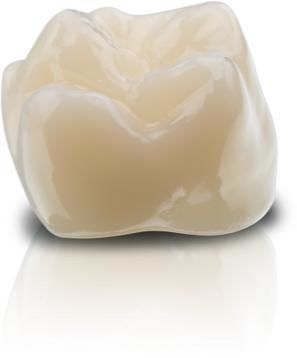 混合动力牙科材料 - VarseoSmile&reg; Crown plus - BEGO - 混合陶瓷 / 树脂材质 / 用于牙冠