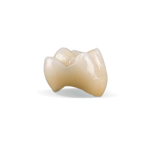 玻璃陶瓷牙科材料 - IPS e.max CAD* - BEGO - 焦硅酸锂 / 用于牙冠 / 用于牙嵌