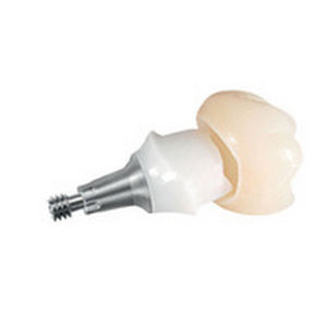 钛种植体基台 - ANKYLOS® TitaniumBase - DENTSPLY Implants GmbH - 内部 / 直线型