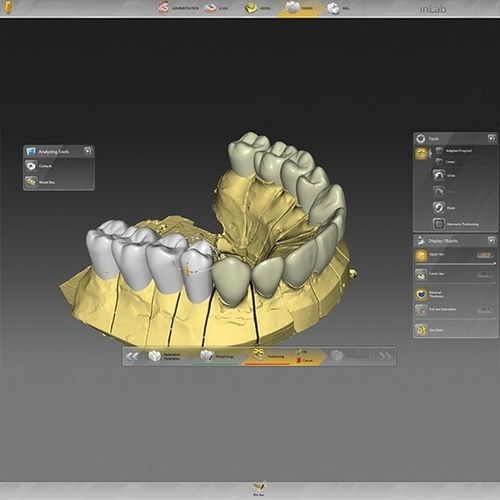 牙科实验室软件 - inLab  - DENTSPLY MAILLEFER/登士柏迈斐 - 口腔移植手术 / 牙齿修复 / 设计