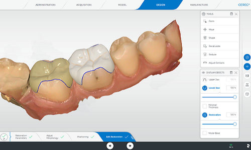 分析软件 - CEREC - DENTSPLY MAILLEFER/登士柏迈斐 - 监护 / 捕获 / 牙科实验室