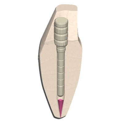 纤维牙根管桩 - EZ-Fit&reg; Fiber - ESSENTIAL DENTAL SYSTEMS  