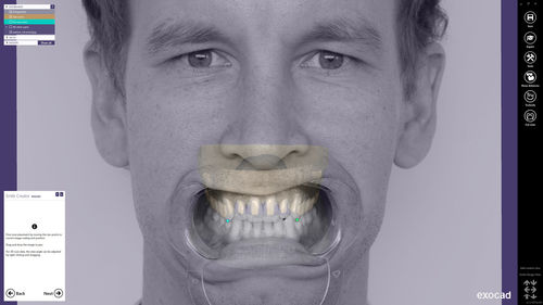 分析软件 - Smile Creator - exocad GmbH   - 规划 / 设计 / CAD