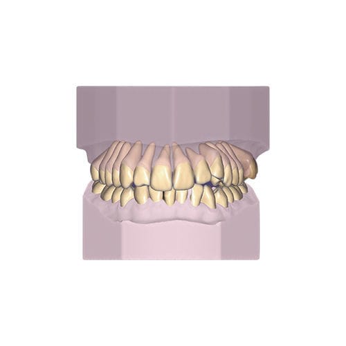 设计软件模块 - Ortho - exocad GmbH   - 模型制作 / 存档 / 正畸