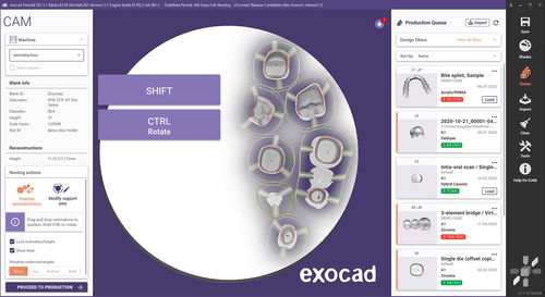医疗数据管理软件 - exocam - exocad GmbH   - 可视化 / 设计 / CAD