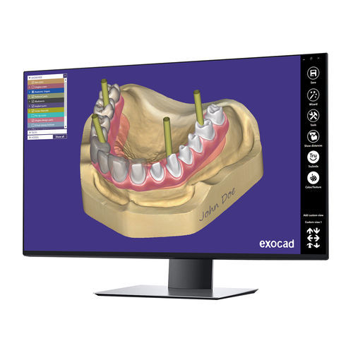 口腔移植手术软件模块 - Implant  - exocad GmbH   - 设计 / CAD