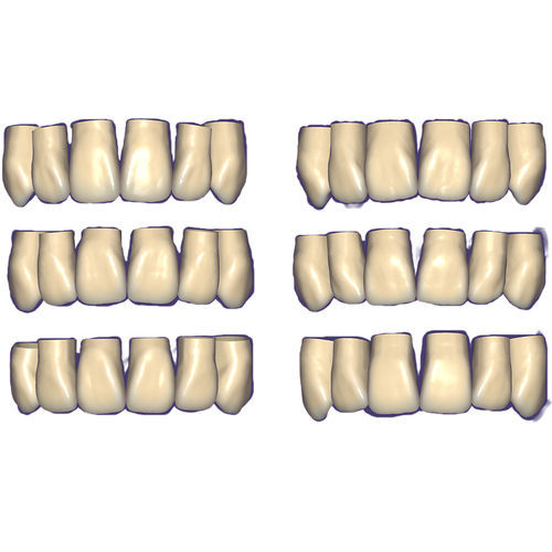 CAD软件模块 - Tooth Library - exocad GmbH   - 牙科 / 牙齿 / 颌骨
