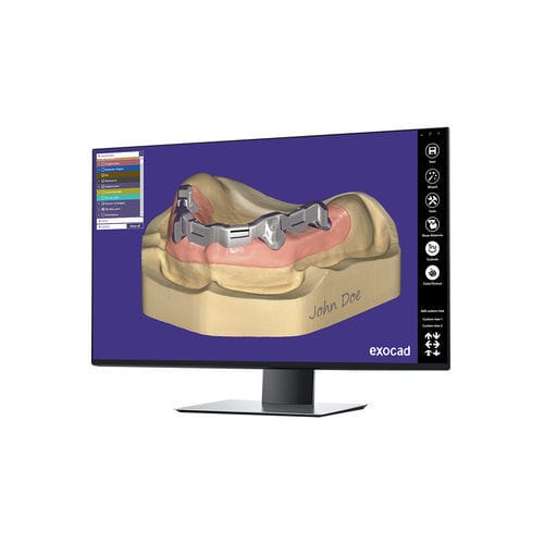 测量软件模块 - Bar - exocad GmbH   - 设计 / CAM / 临床