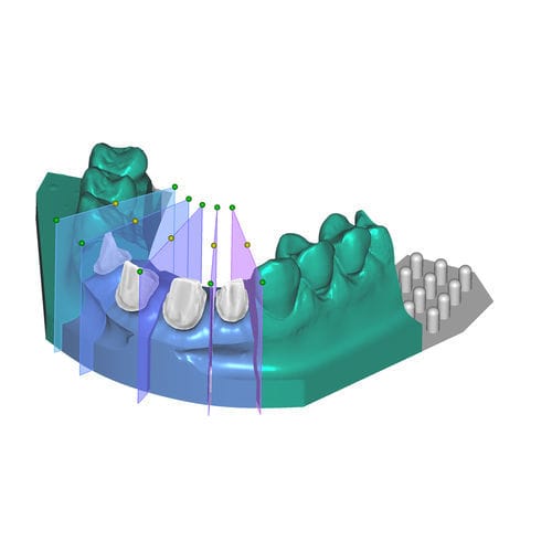 捕获软件模块 - Model Creator - exocad GmbH   - 设计 / 模型制作 / 牙科