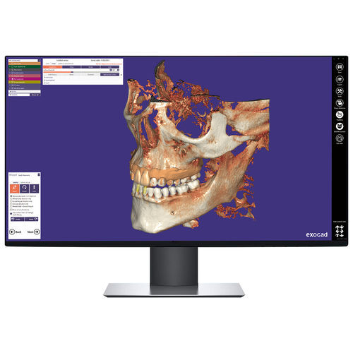 可视化软件模块 - DICPDCAD - exocad GmbH   - DICOM可视化 / 诊断 / 控制