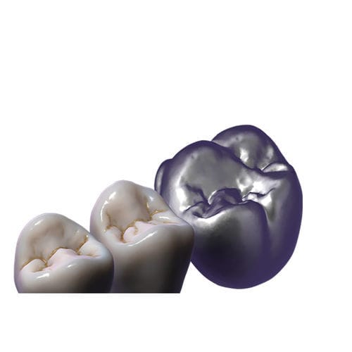 控制软件模块 - TruSmile  - exocad GmbH   - 设计 / CAD / 牙齿修复