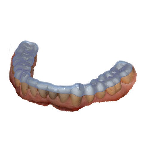 设计软件模块 - Bite Splint - exocad GmbH   - 牙科 / 关节