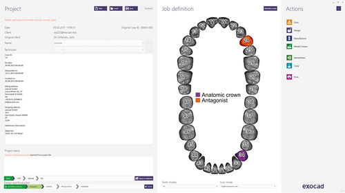 医疗管理软件 - dentalshare - exocad GmbH   - 设计 / CAD / 共享