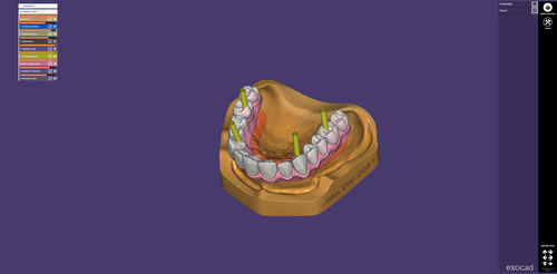 医用Web应用程序 - webview - exocad GmbH   - 牙科 / 共享 / 3D 可视化
