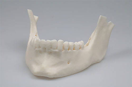 树脂材质牙科材料 - Invicta 915 - DWS Systems - 用于3D打印 / 模型制作 / 液体