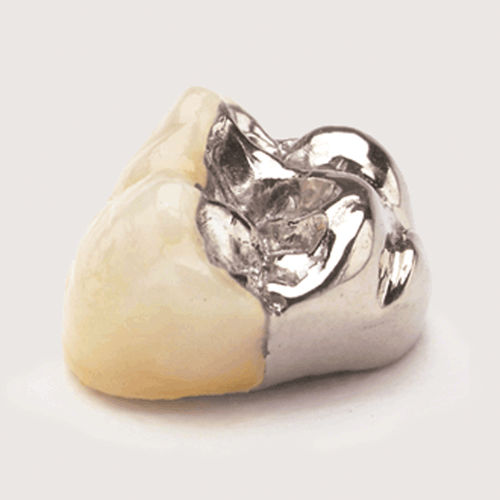 瓷质牙科材料 - JPW - Jensen Dental   - 牙齿修复 / 用于牙桥 / 固体