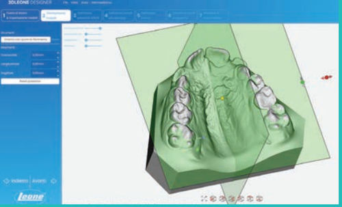 医用设计软件 - LEONE S.p.a.   - CAD / CAM / 牙科实验室