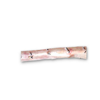 胸主动脉生物人工血管 - CardioGraft® - Lifenet Health   - 同种异体移植