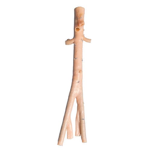 腹主动脉生物人工血管 - AngioGraft® - Lifenet Health   - 髂动脉 / 同种异体移植