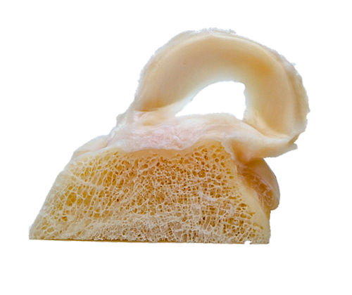 同种异体移植人工半月板 - FlexiGRAFT®  - Lifenet Health  