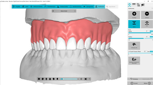 分析软件 - BDCreator® PLUS - Merz Dental GmbH   - 设计 / 导入 / 打印机