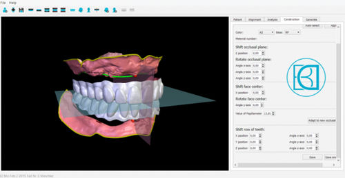 分析软件 - BDCreator® - Merz Dental GmbH   - 控制 / 可视化 / 牙修复体设计