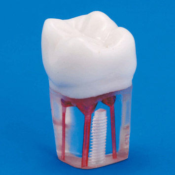 牙齿解剖模型 - S12A-200 - Nissin Dental Products Inc.   - 根管 / 培训 / 透明