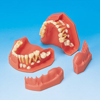 假牙解剖模型 - PE-PDI004 - Nissin Dental Products Inc.   - 牙龈 / 教学 / 儿科