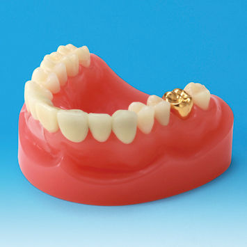 假牙解剖模型 - PE-PRO001 - Nissin Dental Products Inc.   - 牙龈 / 牙齿补体 / 教学