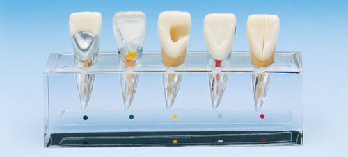 牙科解剖模型 - PE-END001 - Nissin Dental Products Inc.   - 根管 / 用于牙髓 / 教学