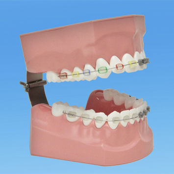 牙齿解剖模型 - PE-ORT002 - Nissin Dental Products Inc.   - 用于口腔卫生 / 牙齿矫正 / 教学