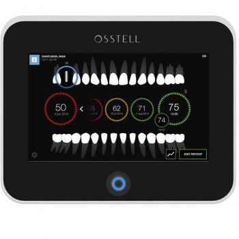 牙科种植物稳定性测试仪 / 带触摸屏 - Osstell IDx - OSSTELL AB  