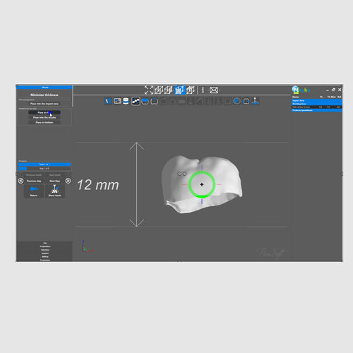 牙科软件 - PICASOFT SAS   - 可视化 / 自动化 / 自动化