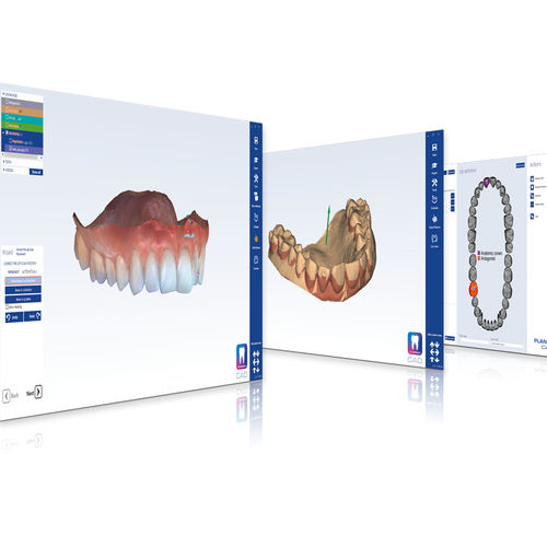CAD/CAM系统 / 牙科 - PlanCAD® Premium - Planmeca/普兰梅卡 - 用于牙科实验室 / 牙科诊所 / 义齿