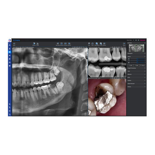 医用软件 - Romexis® - Planmeca/普兰梅卡 - 牙科 / 分析 / 诊断