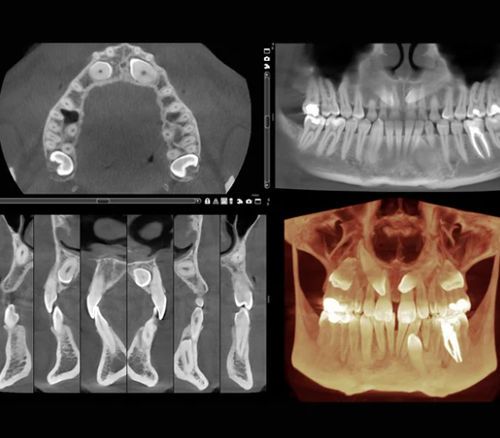 医用软件 - Romexis® 3D - Planmeca/普兰梅卡 - 手术 / 牙科 / 用于牙髓