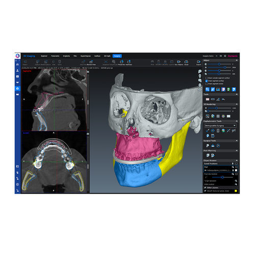 医用软件 - Romexis® CMF - Planmeca/普兰梅卡 - 手术 / 临床 / 可视化