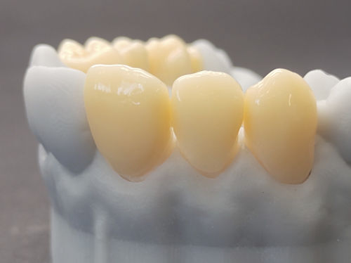 亚克力牙科材料 - CORiTEC temp - pritidenta GmbH - 牙齿修复 / 铣削 / 用于治疗固定托