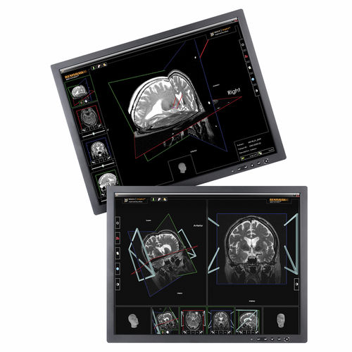 术前统筹软件 - neuroinspire™ - Renishaw - 医用 / 立体定位神经外科手术 / 自动化