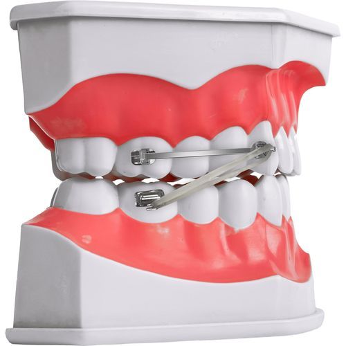 金属下颌正畸托架 - D-bar - SIA ORTHODONTIC MANUFACTURER - 小型 / 曲线 / 直接粘接型