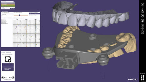 医用设计软件 - exocad  - smart optics Sensortechnik GmbH   - CAD / 牙科 / Windows