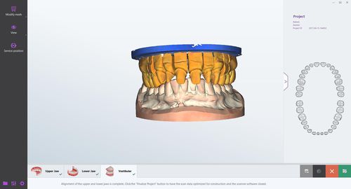 牙科实验室软件 - smart optics Sensortechnik GmbH   - 管理 / 查看 / 设计