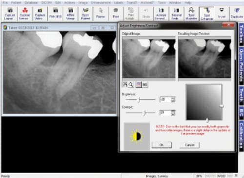图像捕获软件 - Prof. Suni - Suni Medical Imaging - 数据管理 / 诊断 / 用于牙科造影