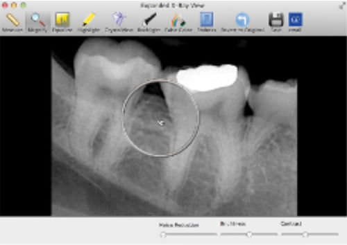 医疗数据管理软件 - SuniMac - Suni Medical Imaging - 图像捕获 / 用于牙科造影